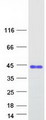 VCX3A Protein - Purified recombinant protein VCX3A was analyzed by SDS-PAGE gel and Coomassie Blue Staining