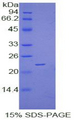 VEGFB Protein - Recombinant Vascular Endothelial Growth Factor B By SDS-PAGE