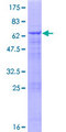 VPS11 Protein - 12.5% SDS-PAGE of human VPS11 stained with Coomassie Blue