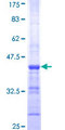 VPS11 Protein - 12.5% SDS-PAGE Stained with Coomassie Blue.