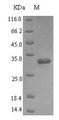 VPS13A / Chorein Protein - (Tris-Glycine gel) Discontinuous SDS-PAGE (reduced) with 5% enrichment gel and 15% separation gel.