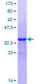 VPS8 Protein - 12.5% SDS-PAGE of human KIAA0804 stained with Coomassie Blue