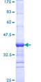 VPS8 Protein - 12.5% SDS-PAGE Stained with Coomassie Blue