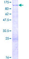 VRTN Protein - 12.5% SDS-PAGE of human C14orf115 stained with Coomassie Blue