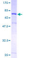WAPAL / WAPL Protein - 12.5% SDS-PAGE of human KIAA0261 stained with Coomassie Blue