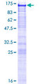 WBP11 Protein - 12.5% SDS-PAGE of human WBP11 stained with Coomassie Blue