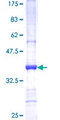WDR19 Protein - 12.5% SDS-PAGE Stained with Coomassie Blue.