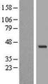 WDR31 Protein - Western validation with an anti-DDK antibody * L: Control HEK293 lysate R: Over-expression lysate