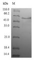 WDR38 Protein - (Tris-Glycine gel) Discontinuous SDS-PAGE (reduced) with 5% enrichment gel and 15% separation gel.