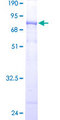 WDR41 Protein - 12.5% SDS-PAGE of human WDR41 stained with Coomassie Blue