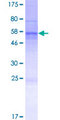 WDR45L Protein - 12.5% SDS-PAGE of human WDR45L stained with Coomassie Blue