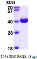 WDR5 Protein