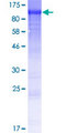 WDR62 Protein - 12.5% SDS-PAGE of human WDR62 stained with Coomassie Blue
