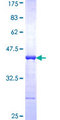 WNK3 / PRKWNK3 Protein - 12.5% SDS-PAGE Stained with Coomassie Blue.