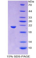 WNT11 Protein - Recombinant Wingless Type MMTV Integration Site Family, Member 11 By SDS-PAGE