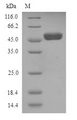 WT1 / Wilms Tumor 1 Protein - (Tris-Glycine gel) Discontinuous SDS-PAGE (reduced) with 5% enrichment gel and 15% separation gel.