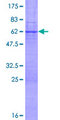 XBP1 Protein - 12.5% SDS-PAGE of human XBP1 stained with Coomassie Blue