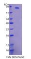 XDH / Xanthine Oxidase Protein - Recombinant  Xanthine Dehydrogenase By SDS-PAGE