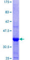 XRCC4 Protein - 12.5% SDS-PAGE Stained with Coomassie Blue.