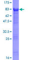 XYLB Protein - 12.5% SDS-PAGE of human XYLB stained with Coomassie Blue