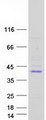 YIPF2 Protein - Purified recombinant protein YIPF2 was analyzed by SDS-PAGE gel and Coomassie Blue Staining