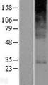 YIPF5 Protein - Western validation with an anti-DDK antibody * L: Control HEK293 lysate R: Over-expression lysate