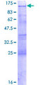 YTHDC1 Protein - 12.5% SDS-PAGE of human YTHDC1 stained with Coomassie Blue