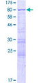 YTHDF2 Protein - 12.5% SDS-PAGE of human YTHDF2 stained with Coomassie Blue