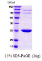 YWHAB / 14-3-3 Beta Protein