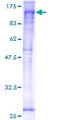 YY1AP1 Protein - 12.5% SDS-PAGE of human YY1AP1 stained with Coomassie Blue
