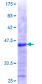 ZBTB25 Protein - 12.5% SDS-PAGE Stained with Coomassie Blue.