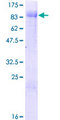 ZBTB46 Protein - 12.5% SDS-PAGE of human ZBTB46 stained with Coomassie Blue