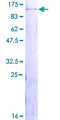 ZBTB48 / HKR3 Protein - 12.5% SDS-PAGE of human ZBTB48 stained with Coomassie Blue