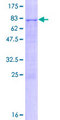 ZCCHC6 Protein - 12.5% SDS-PAGE of human ZCCHC6 stained with Coomassie Blue