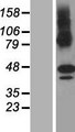 ZDHHC11 Protein - Western validation with an anti-DDK antibody * L: Control HEK293 lysate R: Over-expression lysate