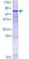 ZDHHC11 Protein - 12.5% SDS-PAGE of human ZDHHC11 stained with Coomassie Blue