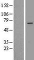ZDHHC16 Protein - Western validation with an anti-DDK antibody * L: Control HEK293 lysate R: Over-expression lysate