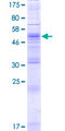 ZDHHC4 Protein - 12.5% SDS-PAGE of human ZDHHC4 stained with Coomassie Blue