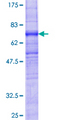 ZDHHC6 Protein - 12.5% SDS-PAGE of human ZDHHC6 stained with Coomassie Blue