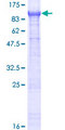ZER1 Protein - 12.5% SDS-PAGE of human ZER1 stained with Coomassie Blue