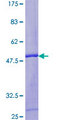 ZFAND1 Protein - 12.5% SDS-PAGE of human ZFAND1 stained with Coomassie Blue