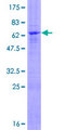 ZFP1 Protein - 12.5% SDS-PAGE of human ZFP1 stained with Coomassie Blue
