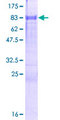 ZFP3 Protein - 12.5% SDS-PAGE of human ZFP3 stained with Coomassie Blue