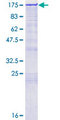 ZFYVE16 Protein - 12.5% SDS-PAGE of human ZFYVE16 stained with Coomassie Blue