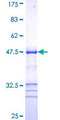 ZFYVE16 Protein - 12.5% SDS-PAGE Stained with Coomassie Blue.