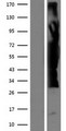 ZFYVE19 Protein - Western validation with an anti-DDK antibody * L: Control HEK293 lysate R: Over-expression lysate