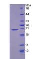 ZG16B Protein - Recombinant  Zymogen Granule Protein 16 Homolog B By SDS-PAGE
