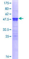 ZMYM5 Protein - 12.5% SDS-PAGE of human ZMYM5 stained with Coomassie Blue