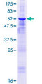 ZMYND12 Protein - 12.5% SDS-PAGE of human ZMYND12 stained with Coomassie Blue