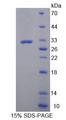 ZNF10 / KOX1 Protein - Recombinant Zinc Finger Protein 10 By SDS-PAGE